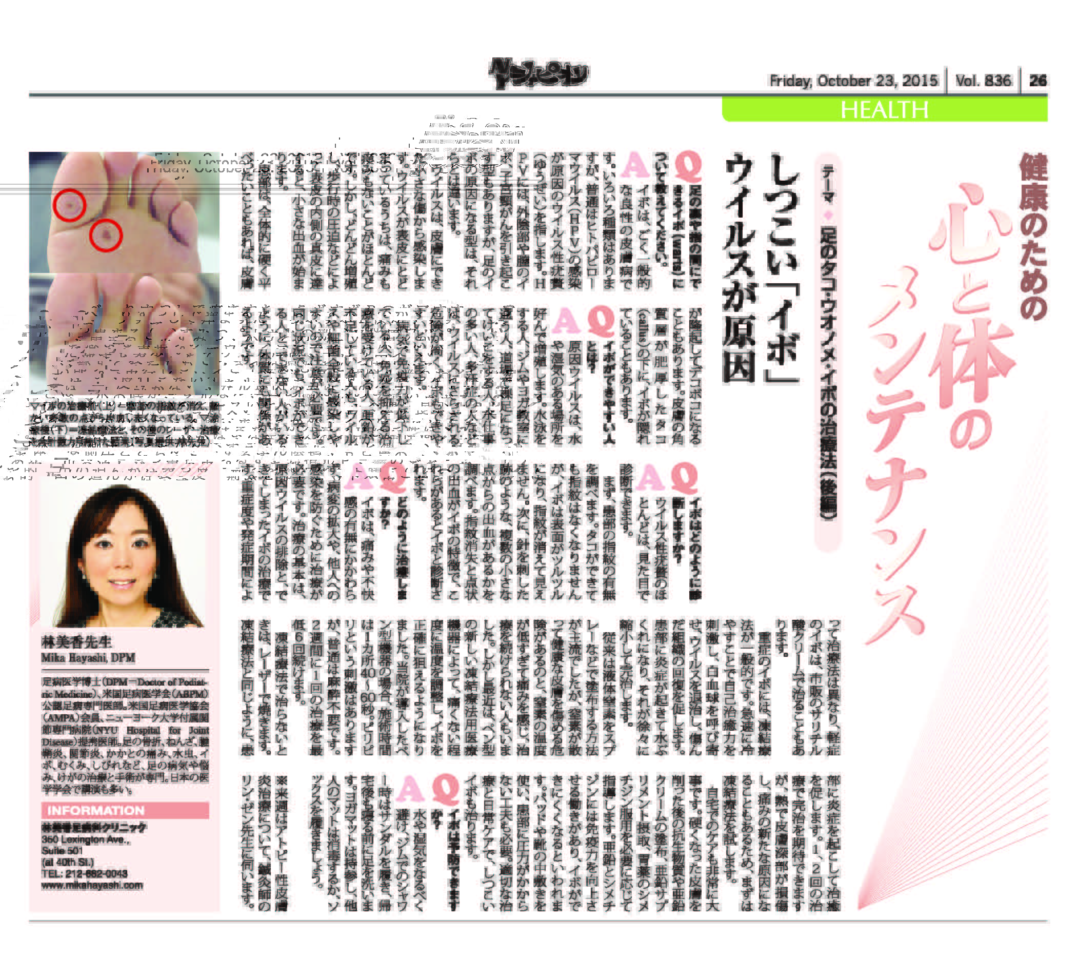 しつこい「イボ」はウイルスが原因